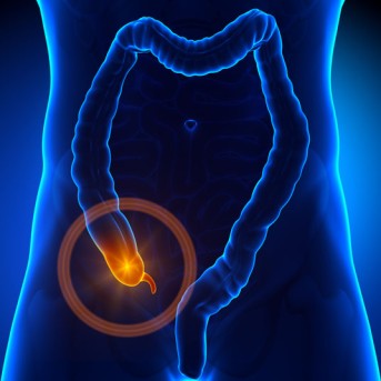 Appendectomy-Removal of Appendix by OrangeCountySurgeons
